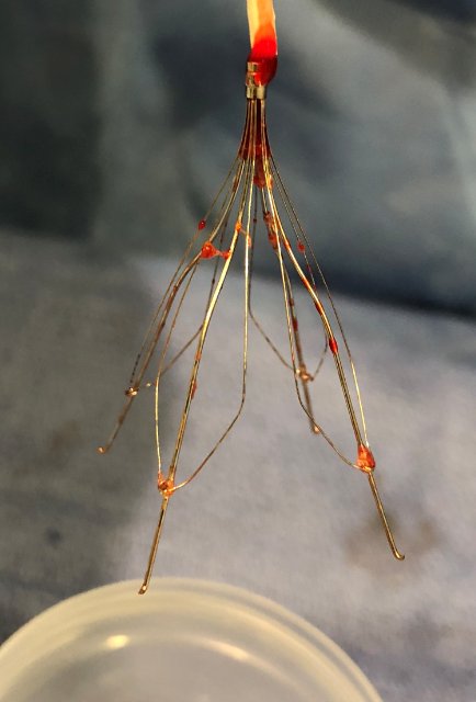 kmadass's tweet photo. Exciting when #Irad hopeful medstudent @KnightsOfNhi snares #filterOut on 1st try! #FutureOfIRisbright @TheRealDoctorOs @rkryu @kush_r_desai @robsheridanavir @SIRRFS @MountSinaiIR @IUIRad @AlbanyIR @SDhandMD @JonnyMoriarty @amdevane @IR_Doctor @Drshiloh @AlexCVIR @LessneVIR https://t.co/IqCLkM2SCP