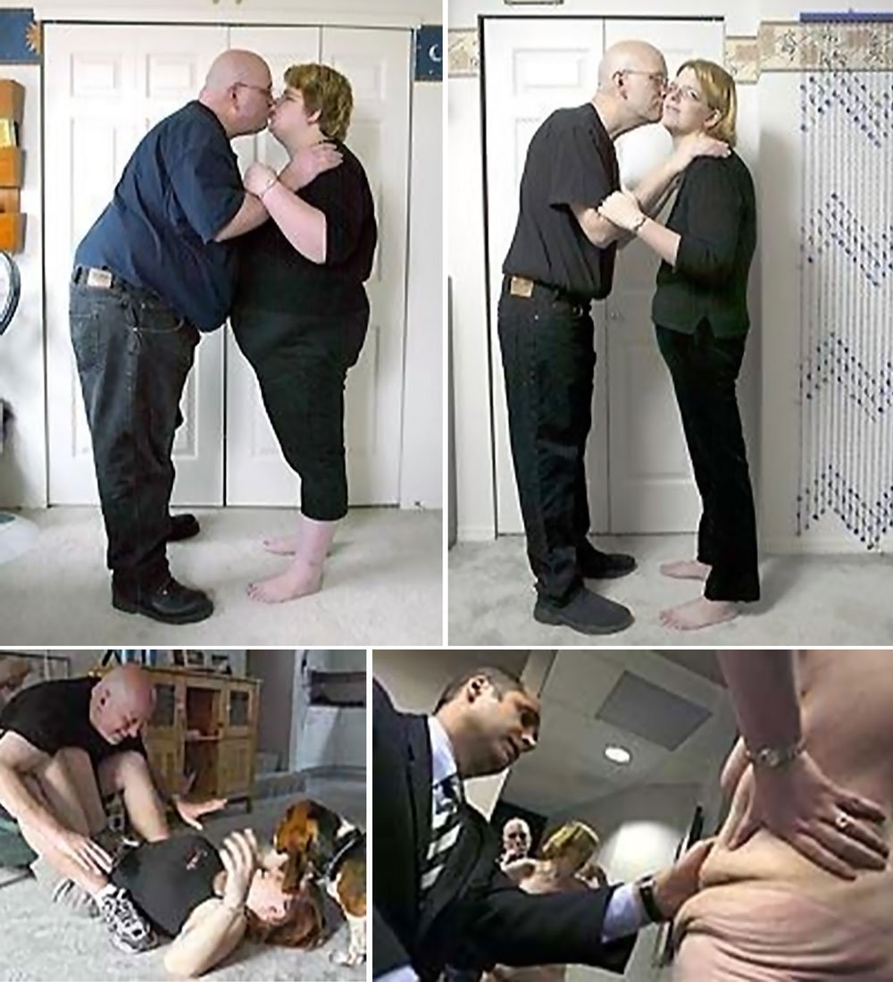 Dr_Egrari's tweet photo. One Year Later, 352 Pounds Lighter.
.
#Flashback to 2004, this lovely couple tells their story of life after #weightlosssurgery 💪👏
.
.
.
#plasticsurgery #postweightloss #postweightlosssurgery #seattletimes #ff #flashbackfriday #cosmeticsurgery #boardcertified #plasticsurgeon https://t.co/LDKtGipxZA