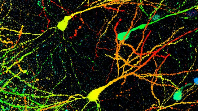 RFurnish's tweet photo. Current #psychiatry research findings could have a large impact on the treatment of #anxietydisorders, which affect 1 in 5 adults in the U.S. See more: https://t.co/VZjz70hroQ https://t.co/xIkMqkZYSd