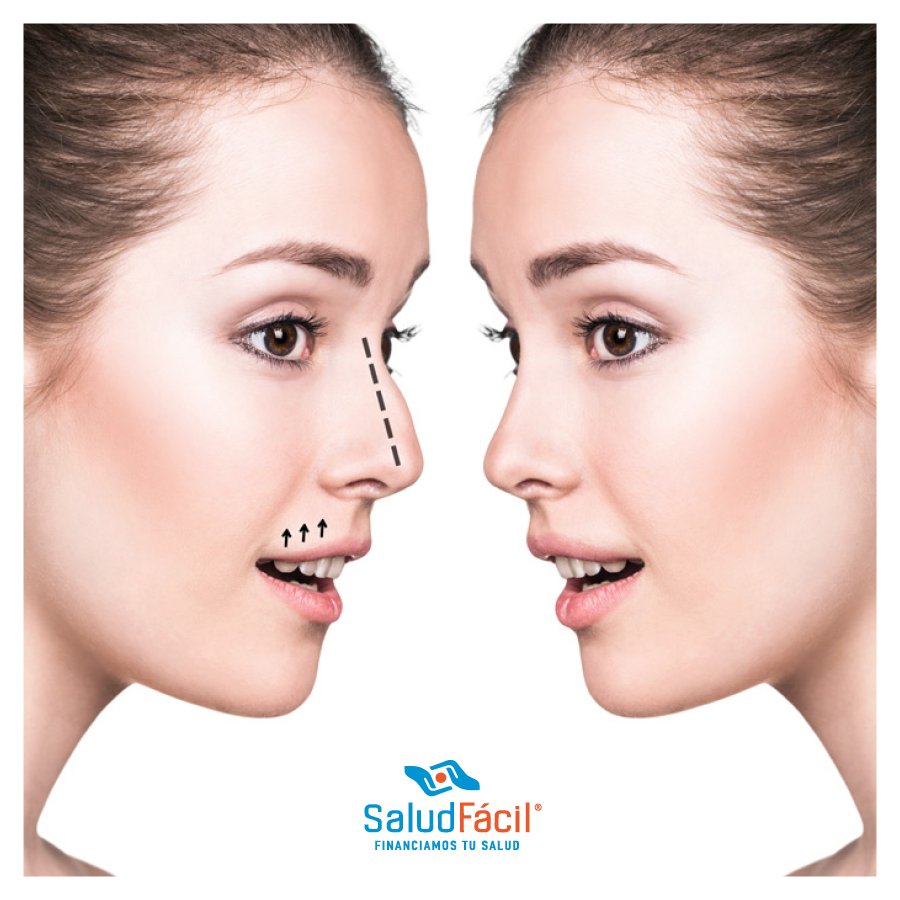 Pequeños cambios que hacen la diferencia. Te prestamos dinero para tu cirugía estética.