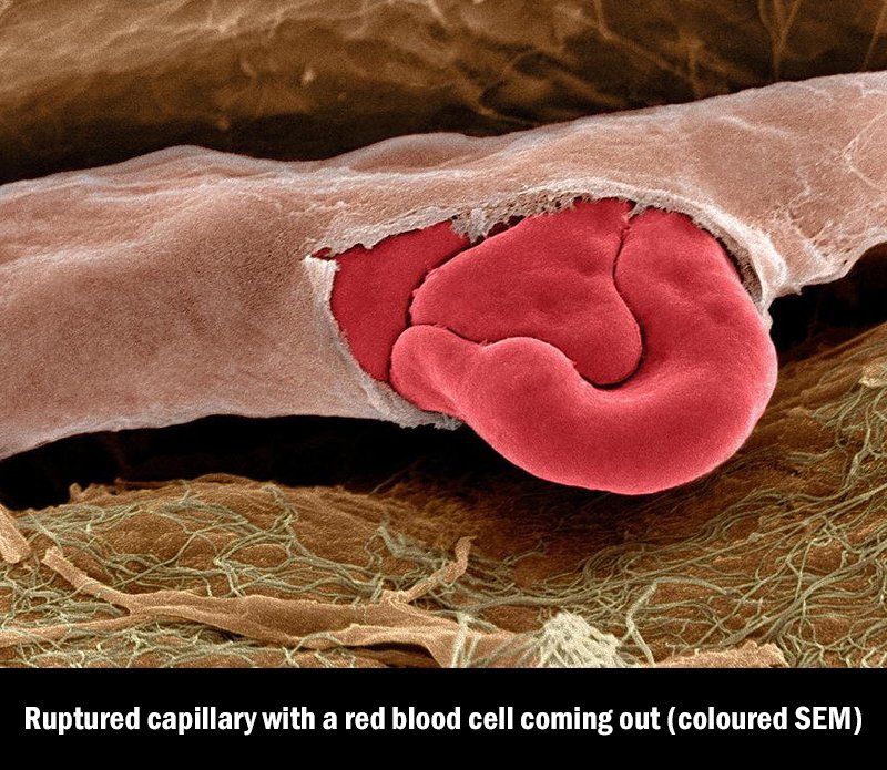 AsapSCIENCE's tweet photo. So cool! [Steve Gschmeissner via Science Photo Library] https://t.co/YyMAurgZjJ