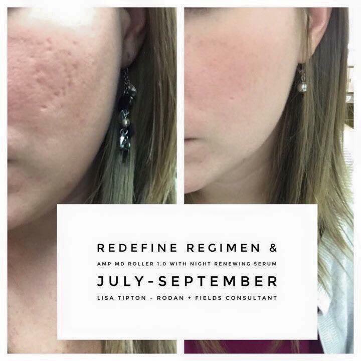 Rodanrodannadan's tweet photo. @theglitchmom Reverse and Redefine. Products from the #1 premium skincare brand in North America. 60 day money back guarantee. #nobrainer 
Check out my profile and let’s get rid of your scars 🤲 https://t.co/KV4XuROCPD