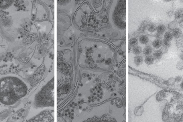 envi_microb's tweet photo. New virus found in the ocean #bacteriakillingviruses #evolution
Access here: https://t.co/nEo4qT0Jn5 / https://t.co/cbd3dDkHsb https://t.co/bAoVUcoWGN
