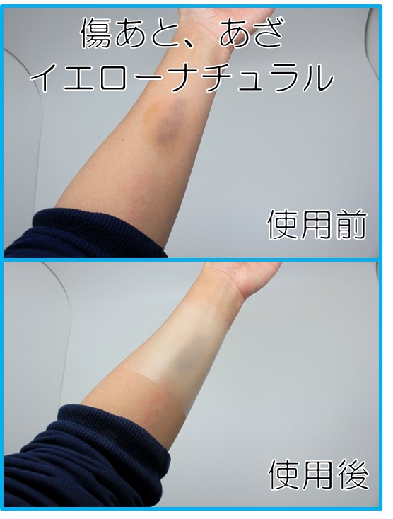 アニメイト札幌 Acos コスプレイヤーに大人気の肌かくしーとが入荷致しました 気になる傷あと あざ 濃い傷あと タトゥー 火傷あと シミなどを 貼って隠す タイプの新感覚スキンカバーシート その他にも眉毛つぶし等にも効果的 展示用サンプルも アニメイト札幌 Acos コスプレイヤーに大人気の肌かくしーとが入荷致しました 気になる傷あと あざ 濃い傷あと タトゥー 火傷あと シミなどを 貼って隠す タイプの新感覚スキンカバーシート その他にも眉毛つぶし等にも効果的 展示用サンプルも