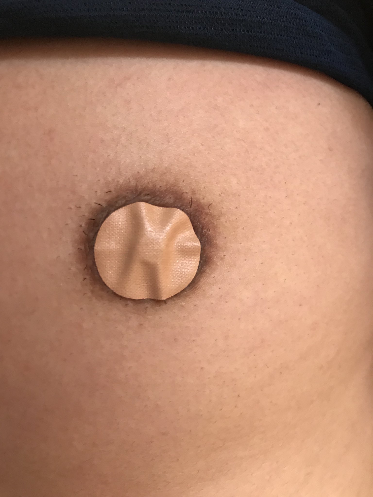 針乳首 乳首開発の最終兵器だって！ 『円皮鍼 スポールバン』 小さい針を乳首 に刺しているだけで、気がついたら１つ上のステージに上がってるって！男でものたうち回るぐらい乳首で感じるようになるって！ホンモノの変態野郎が教えてくれたよ  ...