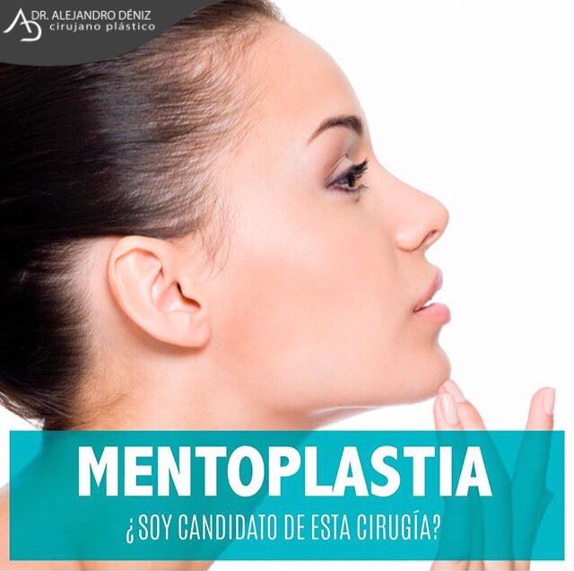 DR_ALEJODENIZ's tweet photo. El agrandamiento del mentón con implantes beneficia a personas que tienen un mentón retraído y que, probablemente tengan una nariz prominente.

La cirugía estética de mentón proporciona definición a la mandíbula y equilibra el aspecto de una nariz grande. https://t.co/U0soZF32ue
