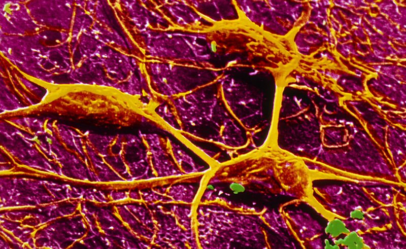 cmkhealthatwork's tweet photo. Superconducting #Synapse may be missing piece for artificial #Brain https://t.co/gvXUmu6gKM Could connect processors & store memories in future neuromorphic computers operating like the human #Brain @usnistgov @jopackaj @naturenews #Neuromorphiccomputers #Change https://t.co/FoFOKaaUmP