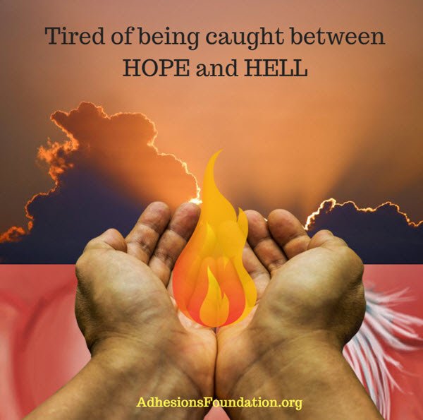 Adhesionshurt's tweet photo. Tired of being caught between Hope and Hell

#Adhesions #ScarTissue #Pain #NeedResearch #NeedHelp #Hell https://t.co/rsYV1td66R