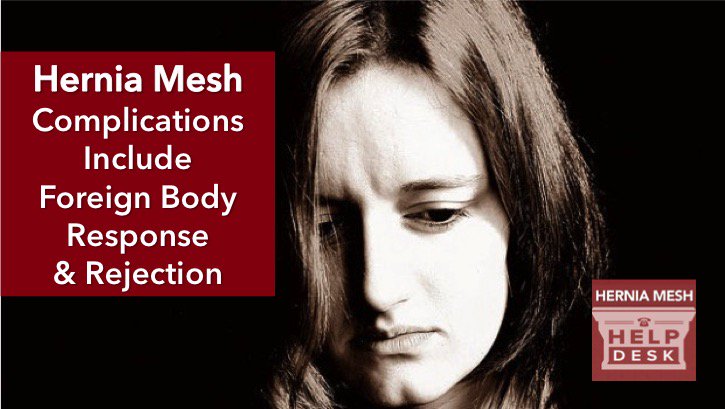 HerniaMeshHelp's tweet image. Is hernia mesh causing your #pain? Learn the complications associated with #herniamesh impactlaw.com/defective-medi…