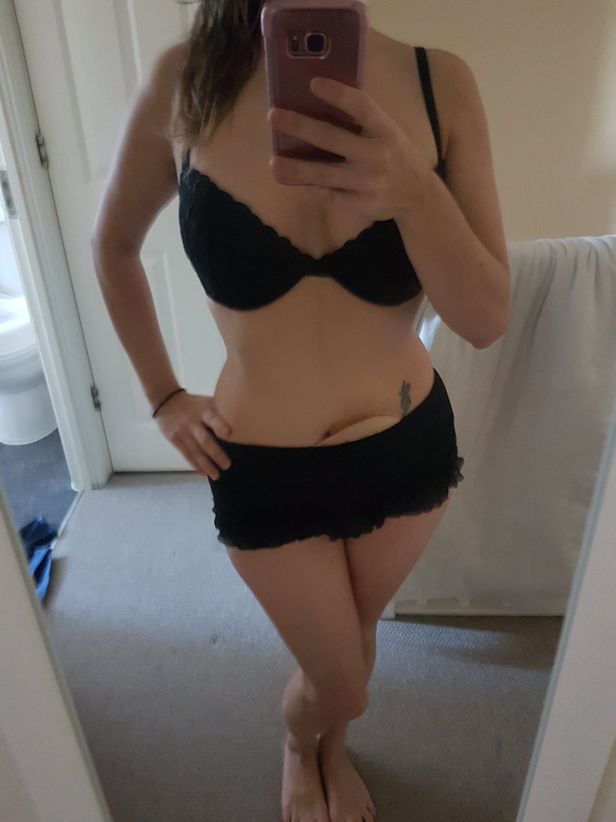 stomainateacup's tweet photo. Bag for life & proud 🙌 @VBlush @SaltsHealthcare #vanillablush #vblush #ostomy #ostomate #ileostomy #ibd #ulcerativecolitis #PositiveMentalAttitude #advocate #stomainateacup https://t.co/8yYzsUAeig