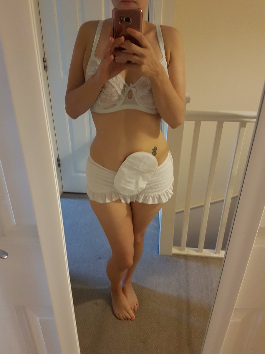 stomainateacup's tweet photo. Bag for life & proud 🙌 @VBlush @SaltsHealthcare #vanillablush #vblush #ostomy #ostomate #ileostomy #ibd #ulcerativecolitis #PositiveMentalAttitude #advocate #stomainateacup https://t.co/8yYzsUAeig
