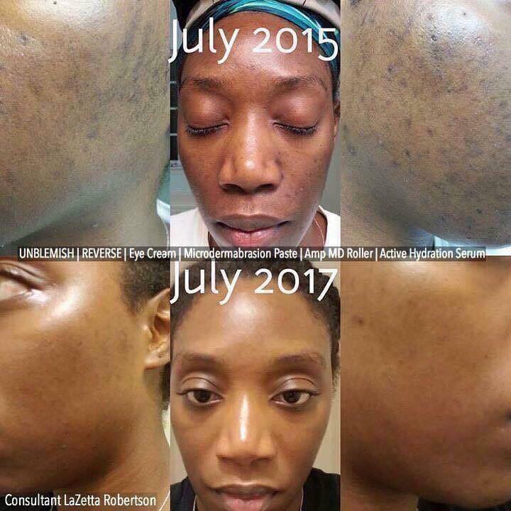 Rodanrodannadan's tweet photo. Products for lightening the appearance of ACNE SCARS??
Reverse from RandF!!
Backed by a 60 day money back guarantee!!
#1 premium skincare brand in NORTH AMERICA!!
We need to TALK!!
#results #skin #acne #pigmentation #scar #beauty #regimen https://t.co/wPX3xd5emm