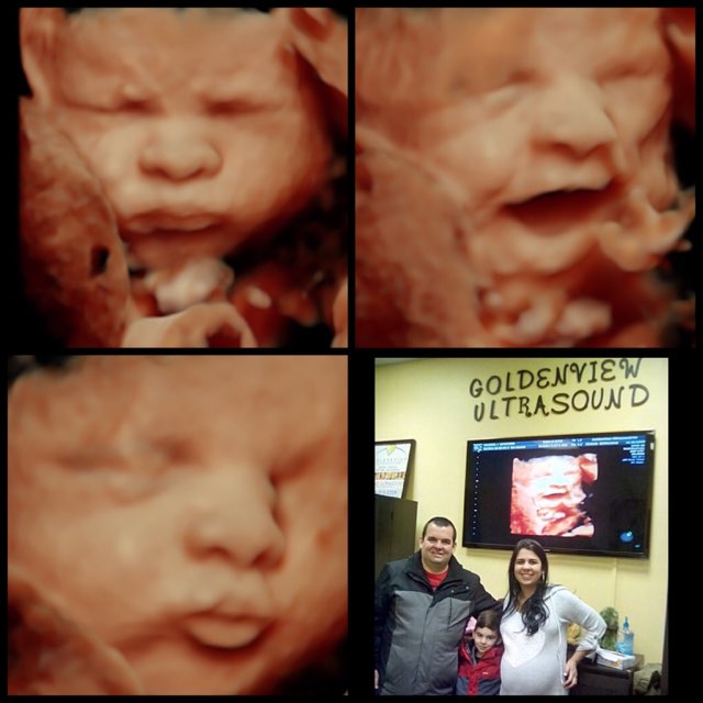 3dUltrasound's tweet photo. These Patriot fans enjoyed an amazing pre-game show of their little kicker at Goldenview Ultrasound .  #3dultrasound #celebratepregnancy #superbowlsunday https://t.co/5heDsZHvGX