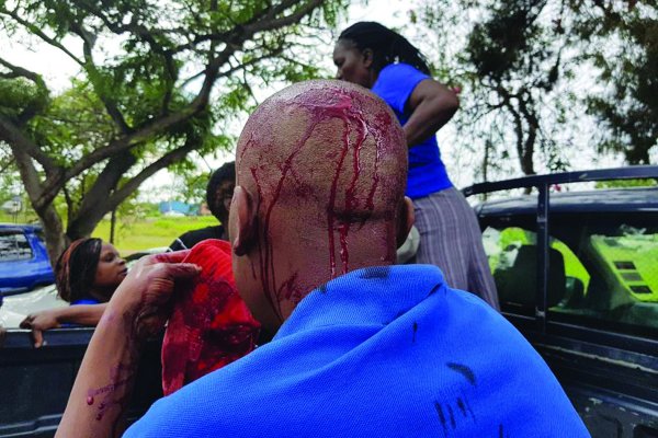 LivingZimbabwe's tweet photo. Political violence escalation irks rights watchdog https://t.co/3M30nGfX77 https://t.co/CdBrasEaV3