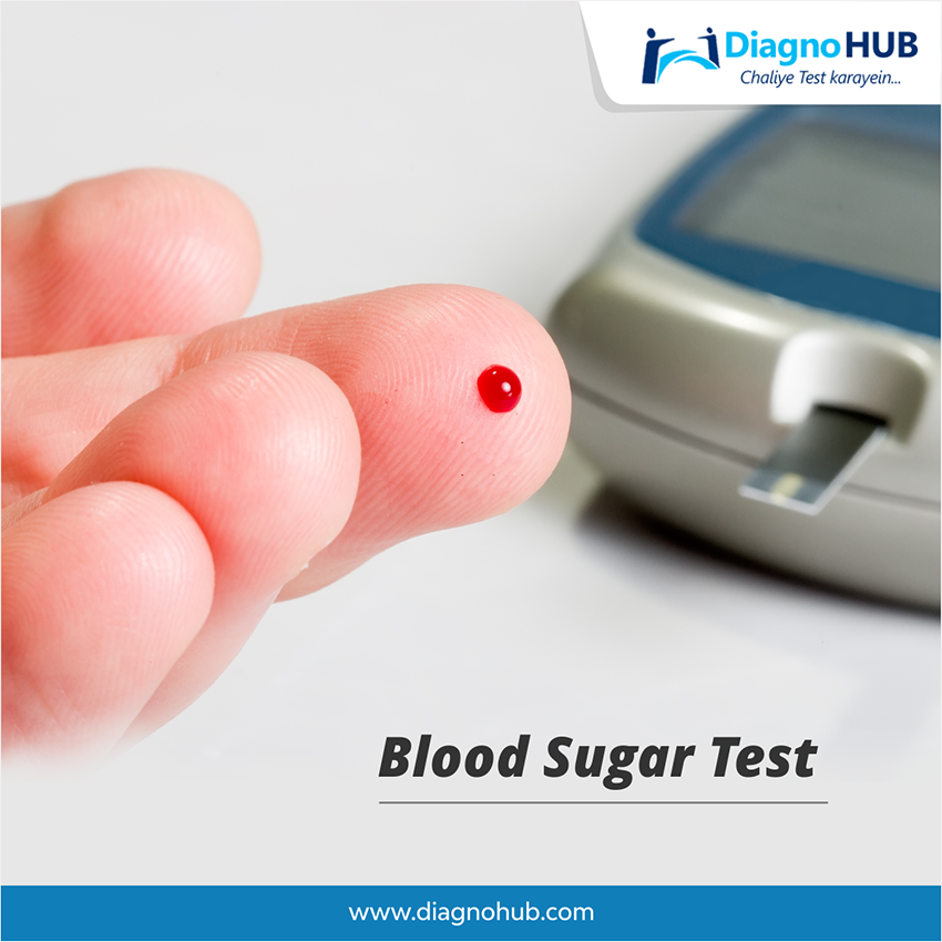 DiagnoHub's tweet photo. A blood glucose test measures the amount of a sugar called glucose in a sample of your blood. Glucose is a major source of energy for most cells of the body. They are quickly turned into glucose in your body. This raises your blood glucose level
#test #testing #Medicare #Tuesday https://t.co/ST7F7RGrkG