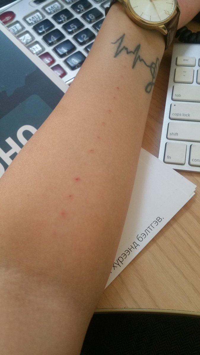 Харшлын сорил тавиулсын уг нь. Сийчээд хаяцым шиг ямар эвгүйнбэ кккк