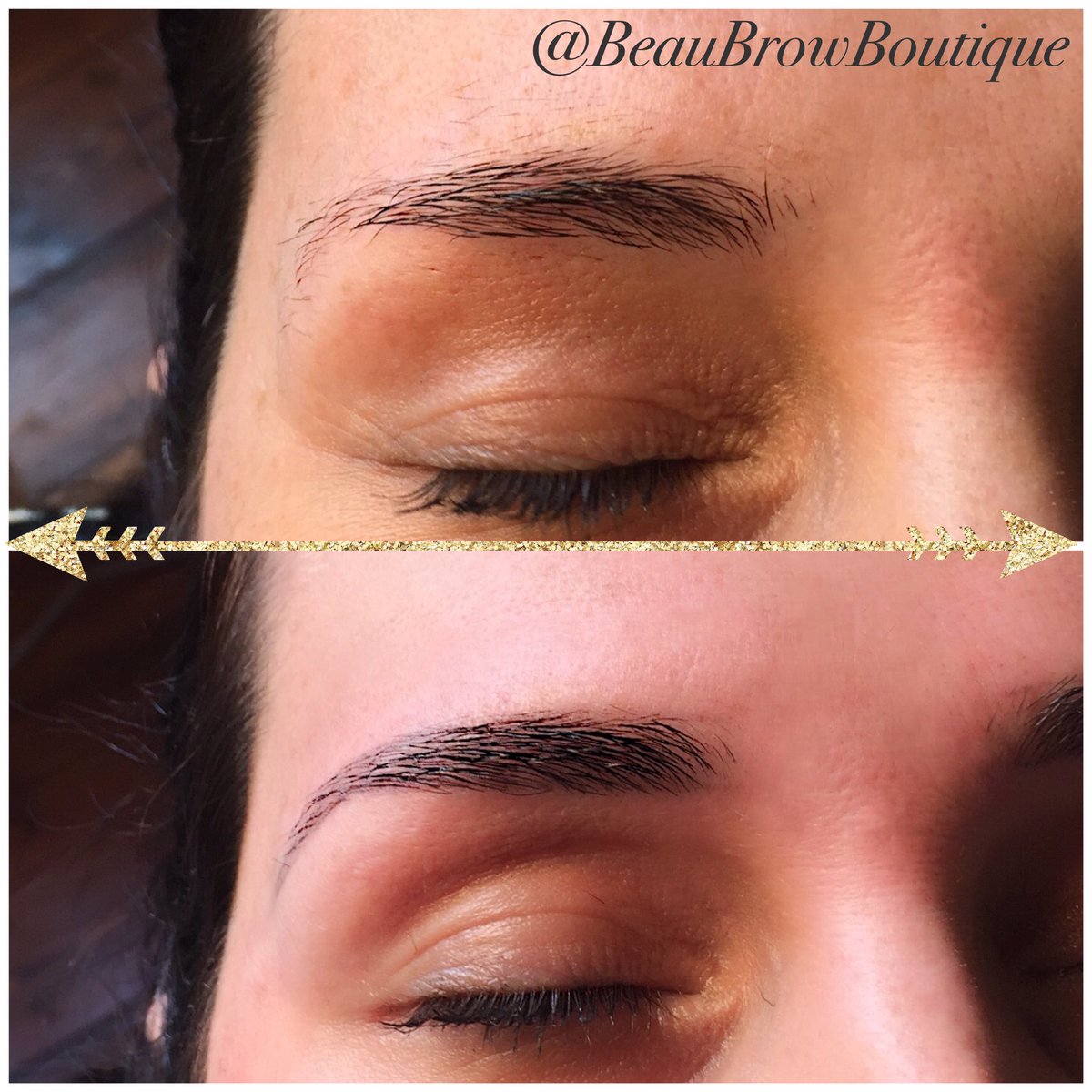 BeauBrowsWorcs's tweet photo. Absolutely love this gorgeous transformation. This is before &amp; after the first treatment 🙌🏼🖤 #hdbrowsworcester #worcestershire #hdbrows #browtransformation #tuesday #morning https://t.co/6MwCIHDrJB