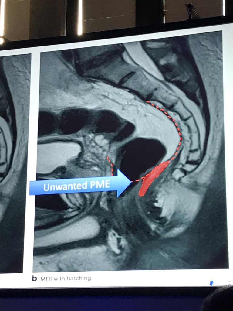 matteo frasson tweet media