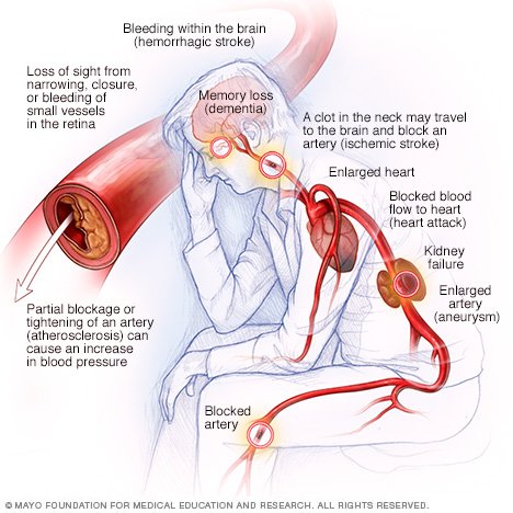 low mpv blood test mayo clinic low mpv blood test mayo clinic
