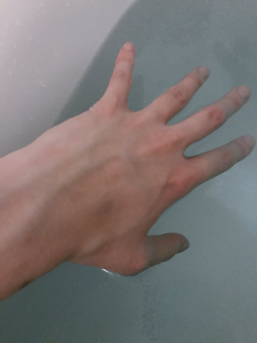 篠原雪斗 男装 ウィズコレ ウィズプラス V Twitter アップできる写真が不足しすぎて風呂で手を撮ったよ なんの意味があるのか って感じだけどお納めください もっとゴリゴリのかっこいい手になりたかったな Oo おやすみ