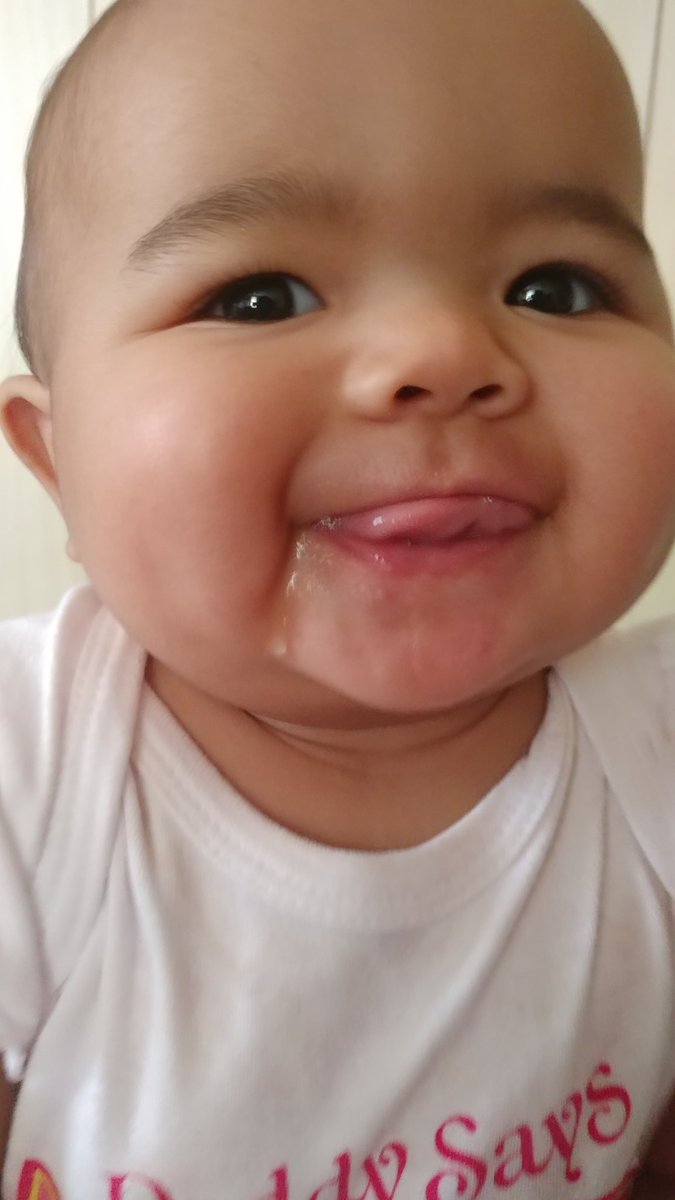 hectic_mgmt's tweet photo. @JamilahLemieux I've wondered if this was a thing!  My daughter is only 7 months old and mixed... You can already kinda see it! https://t.co/ljQzCrEiWE