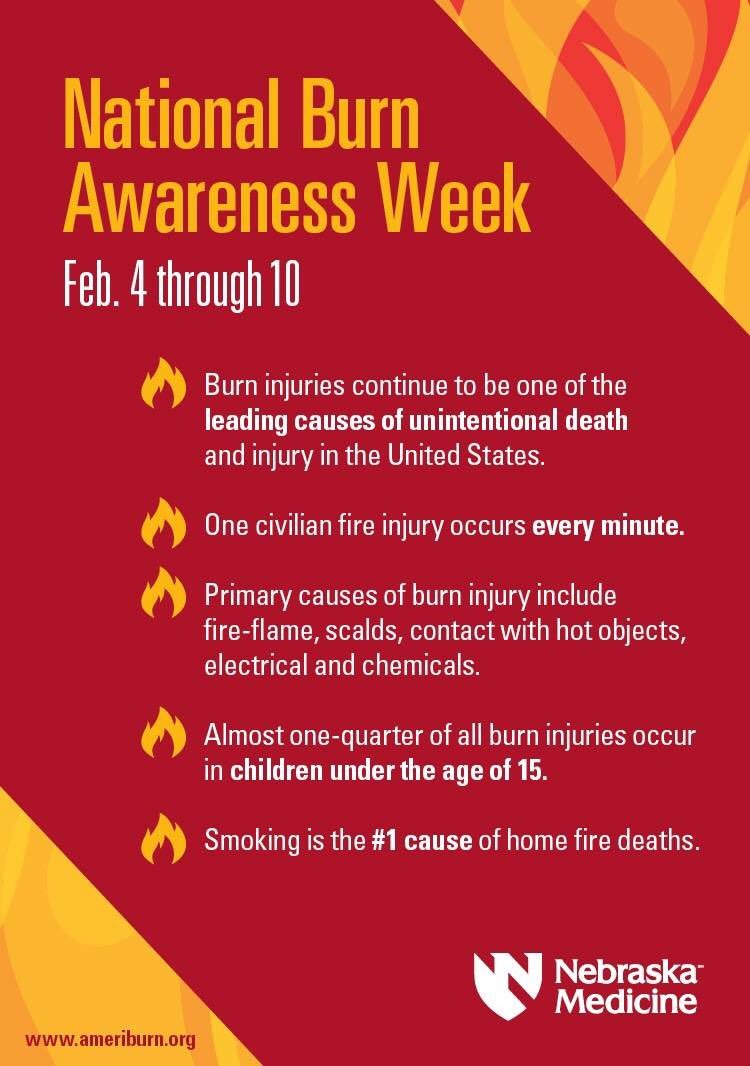 Burn awareness Latest news, Breaking headlines and Top stories, photos