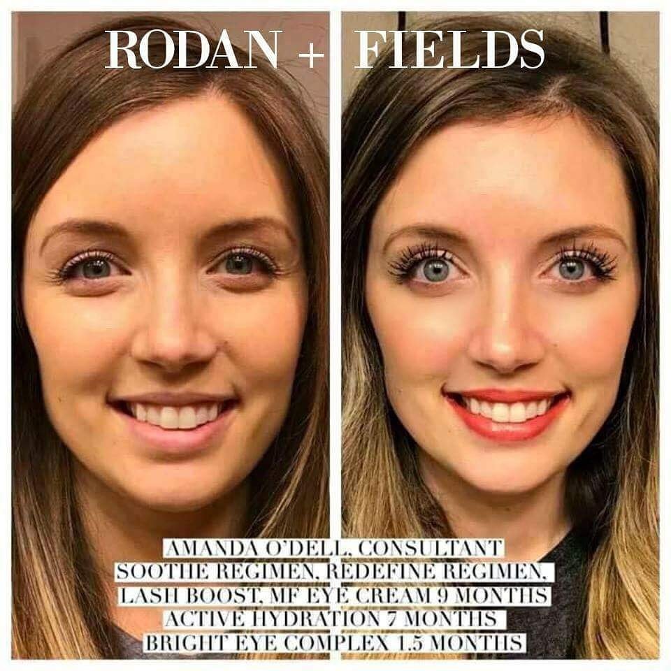 BrandyCarterRF's tweet photo. I often hear, "thanks, but I don't have bad skin"... Well guess what... Either did she. Sometimes it's about improving what is already good and making it GREAT! 👇❤️🙌😉
#ThanksRF #LoveWhatIDo #JoinMe #LashesIn #LashBoost #LashEnvyIsReal #TimeToCallBrandy #LifeChangingSkincare https://t.co/APLzpZlRcb