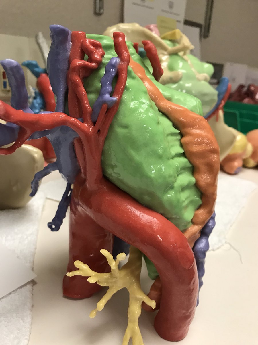 Thanks to <a href="/BrettBerhoff/">Brett Berhoff</a>  for highlighting “How Doctors Use 3D Printing in Healthcare” It was my pleasure to meet him <a href="/MayoClinic/">Mayo Clinic</a> discussing my past history as a #chef <a href="/johnsonandwales/">Johnson & Wales University</a>   traffic.libsyn.com/force-cdn/high…