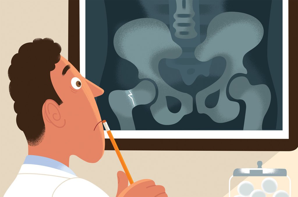 Vilavaite's tweet photo. A perfect storm for broken bones

According to the author, an epidemic of fractures is looming since #osteoporosis is no longer adequately treated

Not sure!🤔

#HipFractures #biphosphonates  @nytimes #radiology https://t.co/PZW1BzHn4m https://t.co/xcLgOYaf75