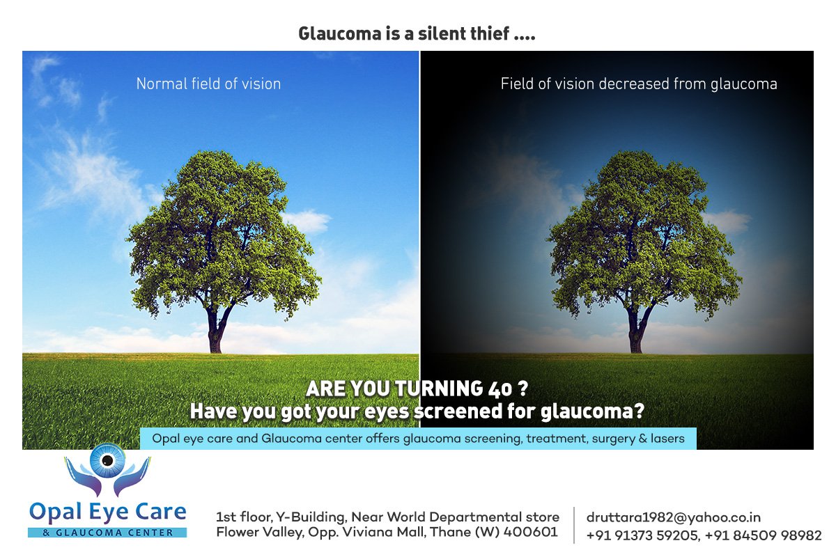 Glaucoma is a silent thief ..... 
Are you turning 40 ? 
have you got your eyes screened for glaucoma?
Opal eye care and glaucoma center offers glaucoma screening , treatment, surgery and lasers
#eyecare #eyehealth #healthyeyes #opaleyecare #glaucoma #qualitytreatment