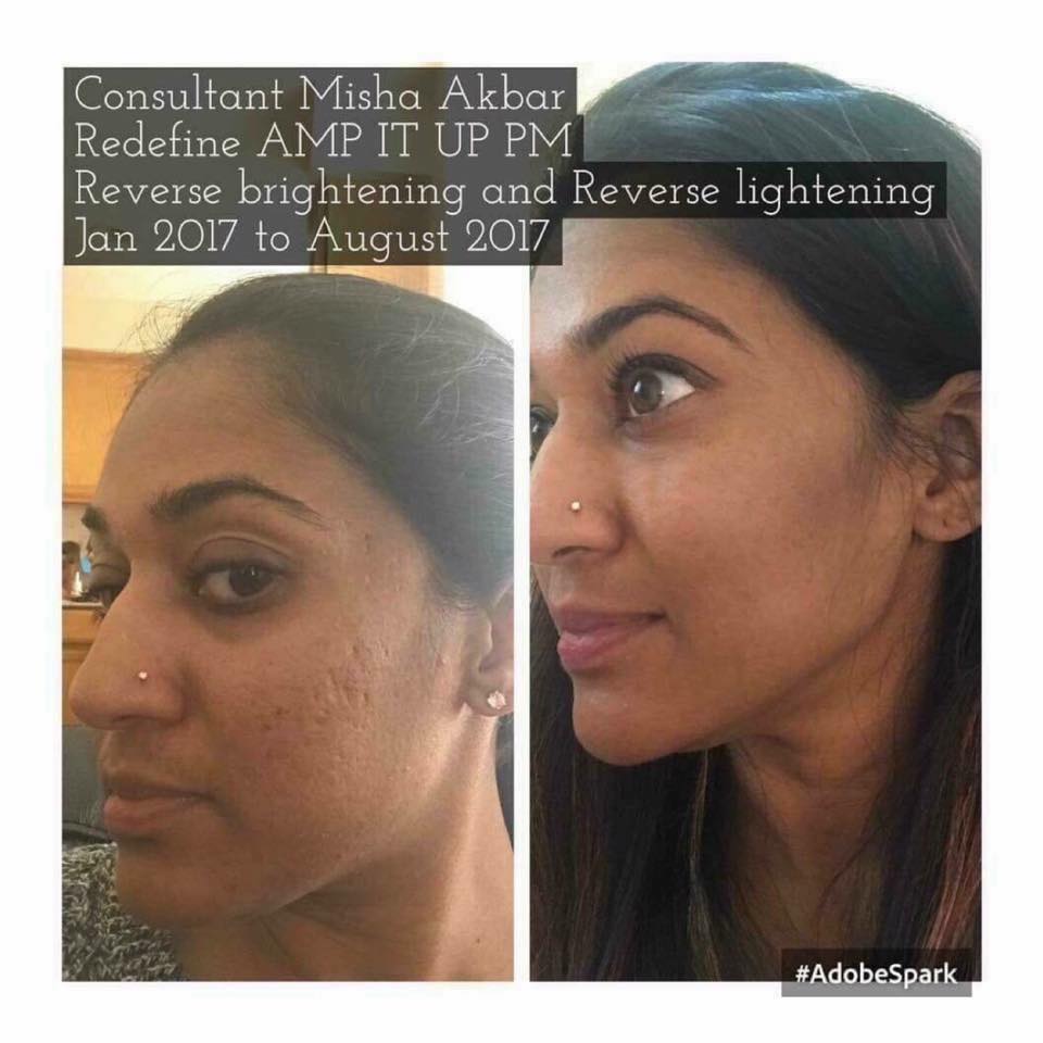 Rodanrodannadan's tweet photo. @KorinaEliza Girl, we have the products to get you on the road to better skin!
Come with 60 day money back guarantee. 
Take our free solution tool. It is a brief questionnaire that will give you personal recommendations. Then we can chat and figure out what you need!
https://t.co/xvi9TGZSrq https://t.co/5MxgAce6lz