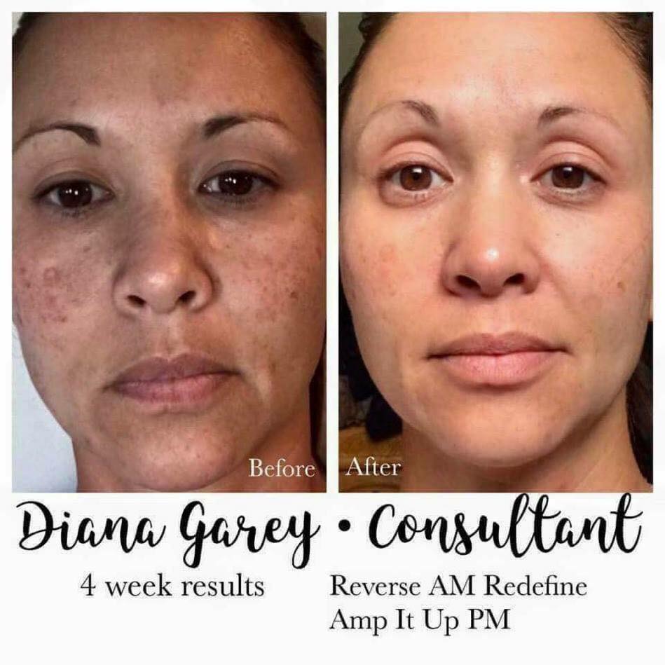 Rodanrodannadan's tweet photo. @KorinaEliza Girl, we have the products to get you on the road to better skin!
Come with 60 day money back guarantee. 
Take our free solution tool. It is a brief questionnaire that will give you personal recommendations. Then we can chat and figure out what you need!
https://t.co/xvi9TGZSrq https://t.co/5MxgAce6lz