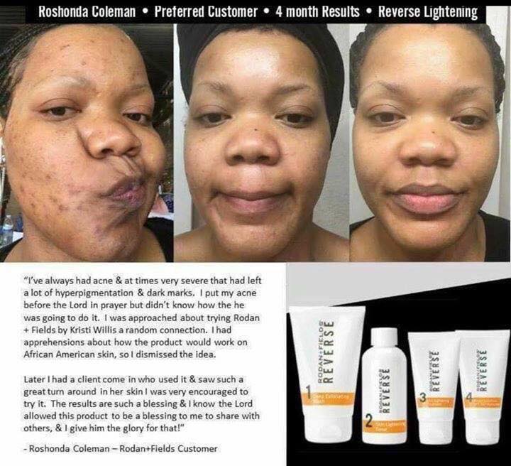 Rodanrodannadan's tweet photo. @KorinaEliza Girl, we have the products to get you on the road to better skin!
Come with 60 day money back guarantee. 
Take our free solution tool. It is a brief questionnaire that will give you personal recommendations. Then we can chat and figure out what you need!
https://t.co/xvi9TGZSrq https://t.co/5MxgAce6lz