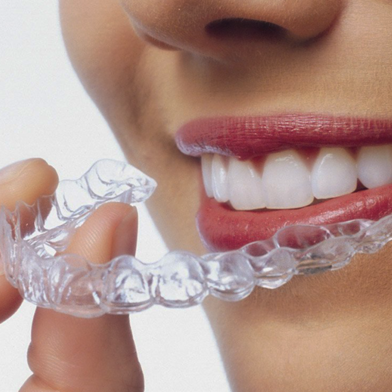 VDCDubai's tweet photo. .@Invisalign can give you the smile you’ve always wanted without the #braces you’ve always avoided.

Contact us at +971 4 4298288 or visit https://t.co/pSs4yIJBZd https://t.co/6uv7yuZMPv