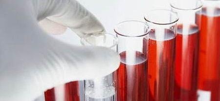 JohnSmithblr's tweet photo. How should deal with the increased creatinine? https://t.co/Vl1W0YQIKP https://t.co/luOdKH5B9v