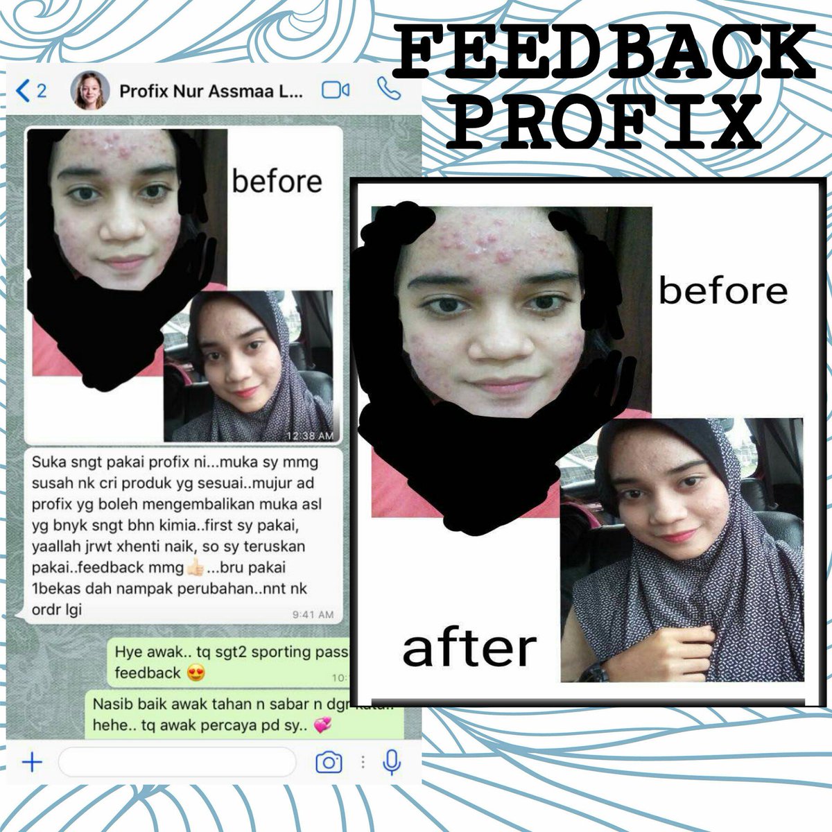 profix_cheras's tweet image. Alhamdulillah. Seronok tgk feedback2 dr pengguna2 Profix. Rata semuanya happy sbb dpt rawat mslh kulit muka masing2. 😇

Cust happy, sis lg yeppiiii. 🤗

☎ wasap.my/60196442549

#profix #codcheras #alvateam