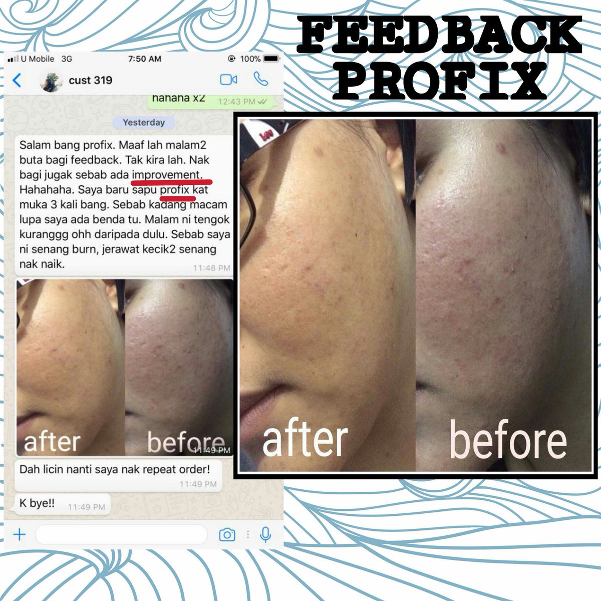 profix_cheras's tweet image. Alhamdulillah. Seronok tgk feedback2 dr pengguna2 Profix. Rata semuanya happy sbb dpt rawat mslh kulit muka masing2. 😇

Cust happy, sis lg yeppiiii. 🤗

☎ wasap.my/60196442549

#profix #codcheras #alvateam