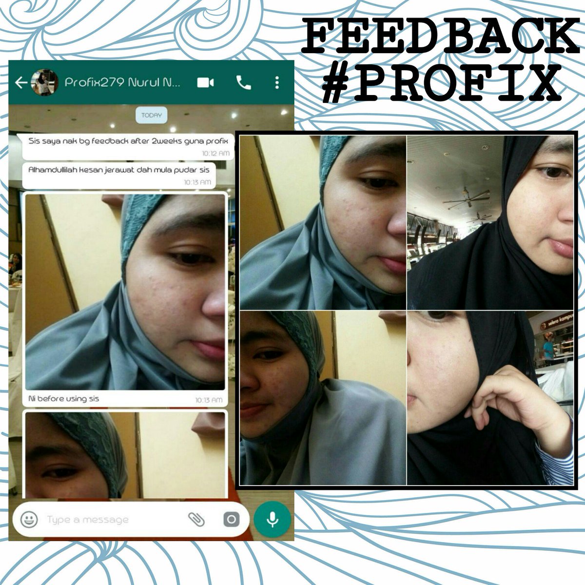profix_cheras's tweet image. Alhamdulillah. Seronok tgk feedback2 dr pengguna2 Profix. Rata semuanya happy sbb dpt rawat mslh kulit muka masing2. 😇

Cust happy, sis lg yeppiiii. 🤗

☎ wasap.my/60196442549

#profix #codcheras #alvateam