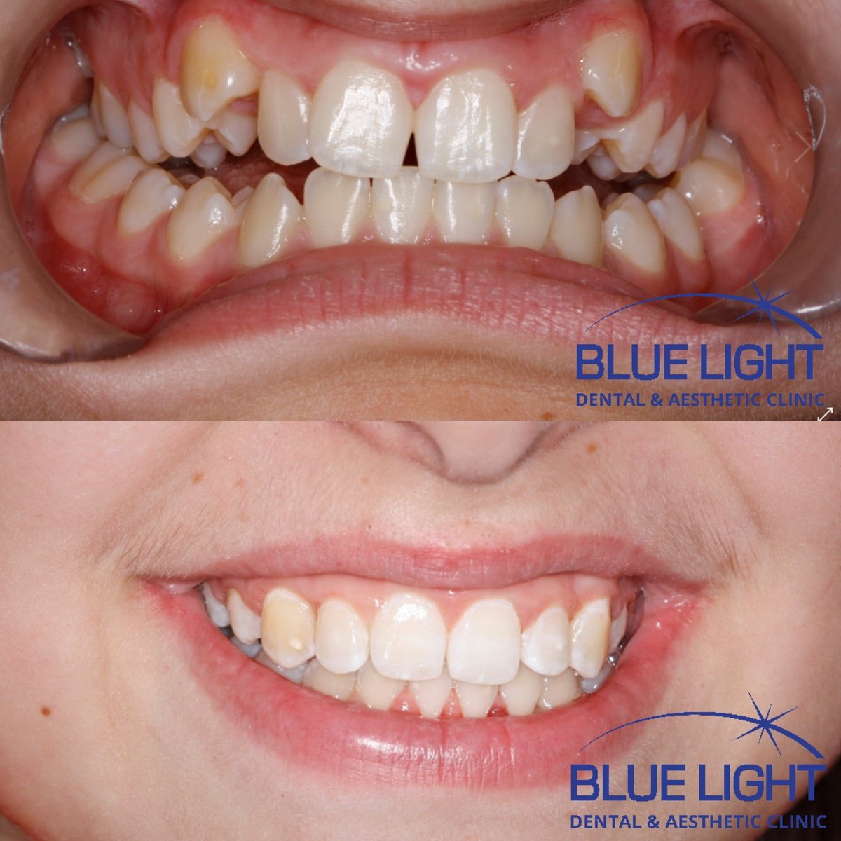 Blue Light Dental (bluelightdental) Twitter