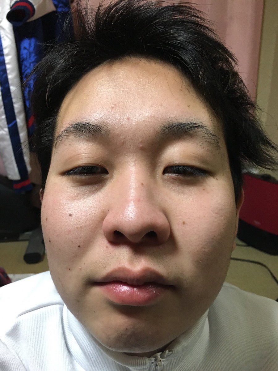 O Xrhsths H Sto Twitter 1枚目ふくれな Fukurena0924 2枚目ごみぶち socccer 友達がふくれ なのすっぴんに激似な件 O Xrhsths H Sto Twitter 1枚目ふくれな Fukurena0924 2枚目ごみぶち socccer 友達がふくれ なのすっぴんに激似な件