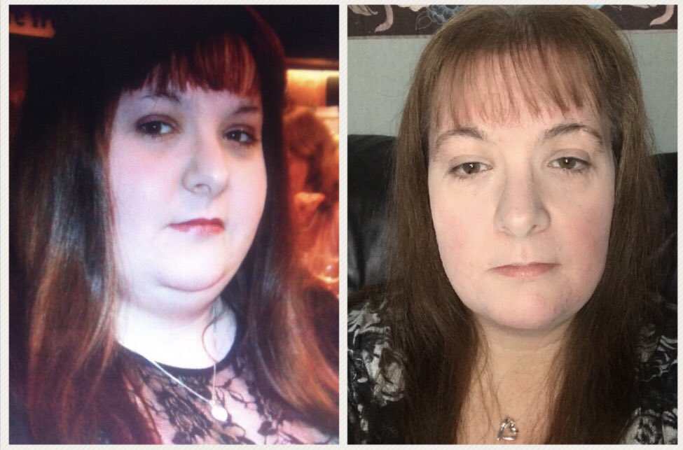 chocdream14's tweet photo. My weight loss journey 8 stone gone https://t.co/IVKG6cPJQ4