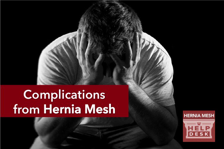 HerniaMeshHelp's tweet image. Is hernia mesh causing your #pain? Learn the complications associated with #herniamesh ==&amp;gt; impactlaw.com/defective-medi…