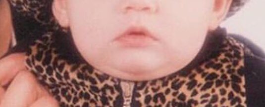 mortuiinside's tweet image. #kyliejennerbaby #KylieJenner 
Stormi has her mother’s lips