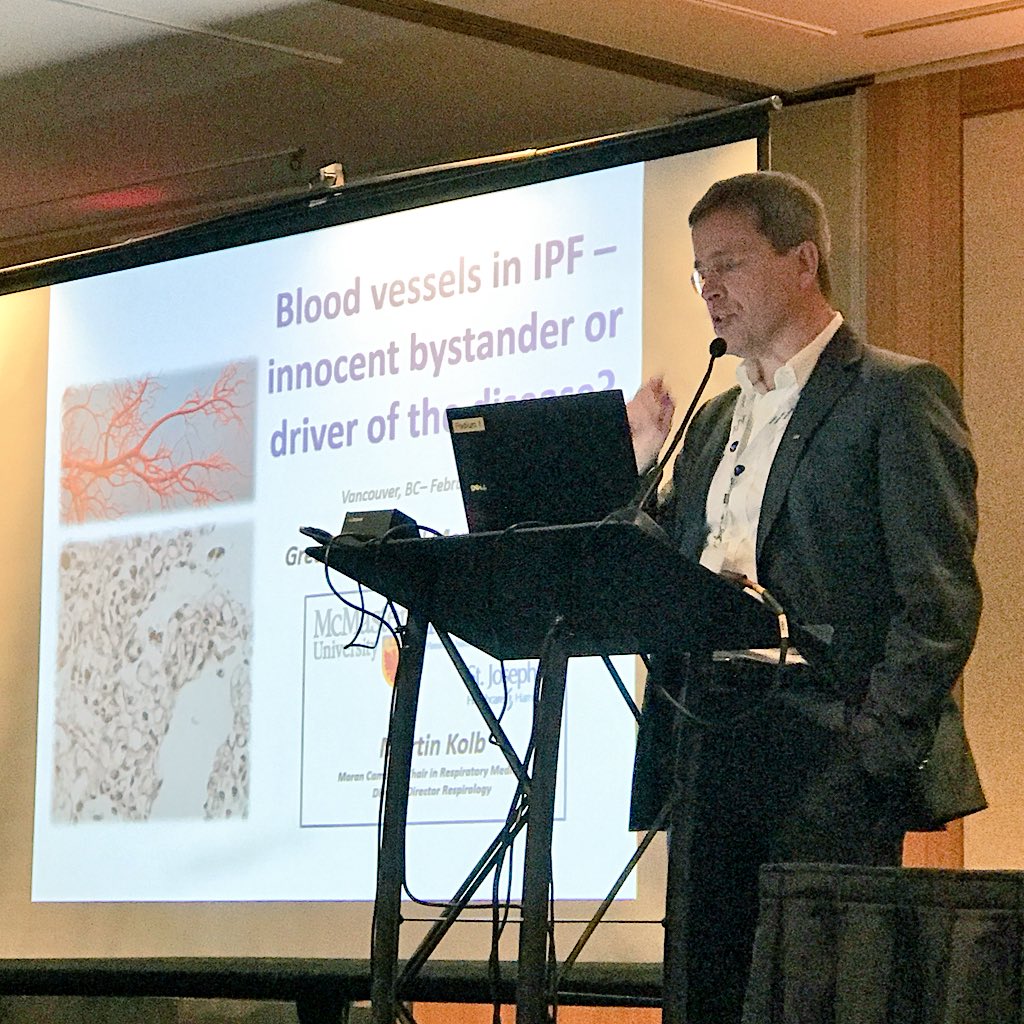 HeartandLung's tweet photo. Dr. Martin Kolb gives Graeme Copland Memorial Lecture, shares insights on study in causes of Idiopathic Pulmonary Fibrosis, and role of blood vessels in #IPF #raredisease #2018FEST #lungdisease https://t.co/58WBmcN3ht