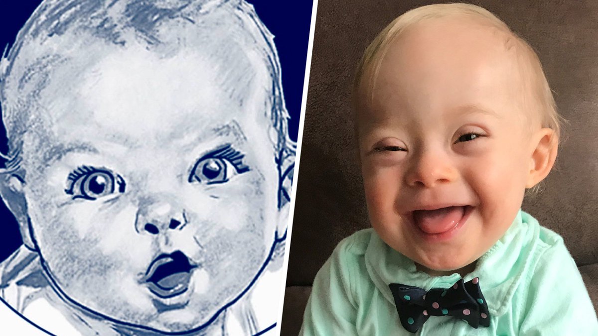 Meet the first Gerber baby with Down syndrome; his name is Lucas! today.com/amp/parents/20…