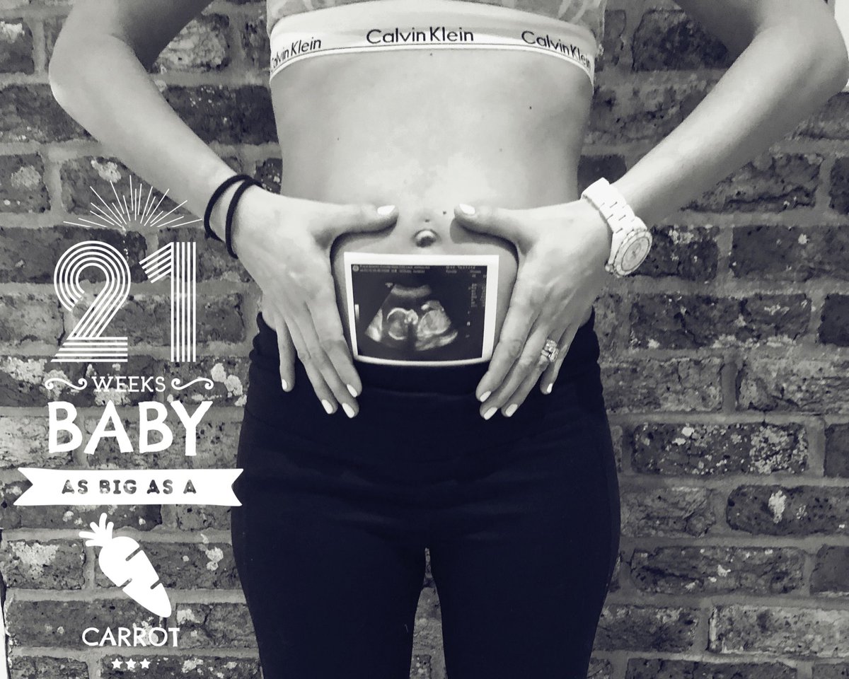 Anna_L_Collins's tweet photo. My baby girl is growing well, passed the anomaly scan all ok, belly is growing, she is moving & we cannot wait to meet her in June #pregnancy #20weeksscan π€° π https://t.co/XCo9ipSvTL