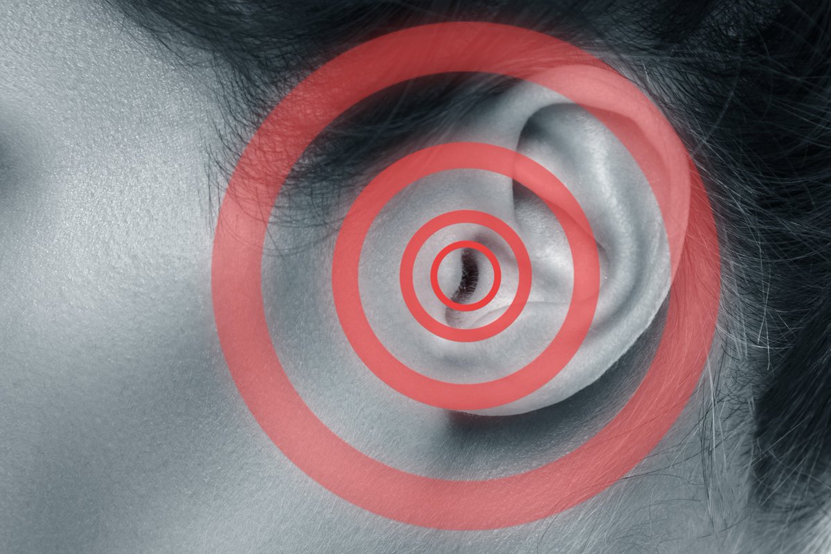 MidwestENTmn's tweet photo. Do you suffer from tinnitus? 
https://t.co/dTFYsJVoqQ https://t.co/5SSSLRFZ36