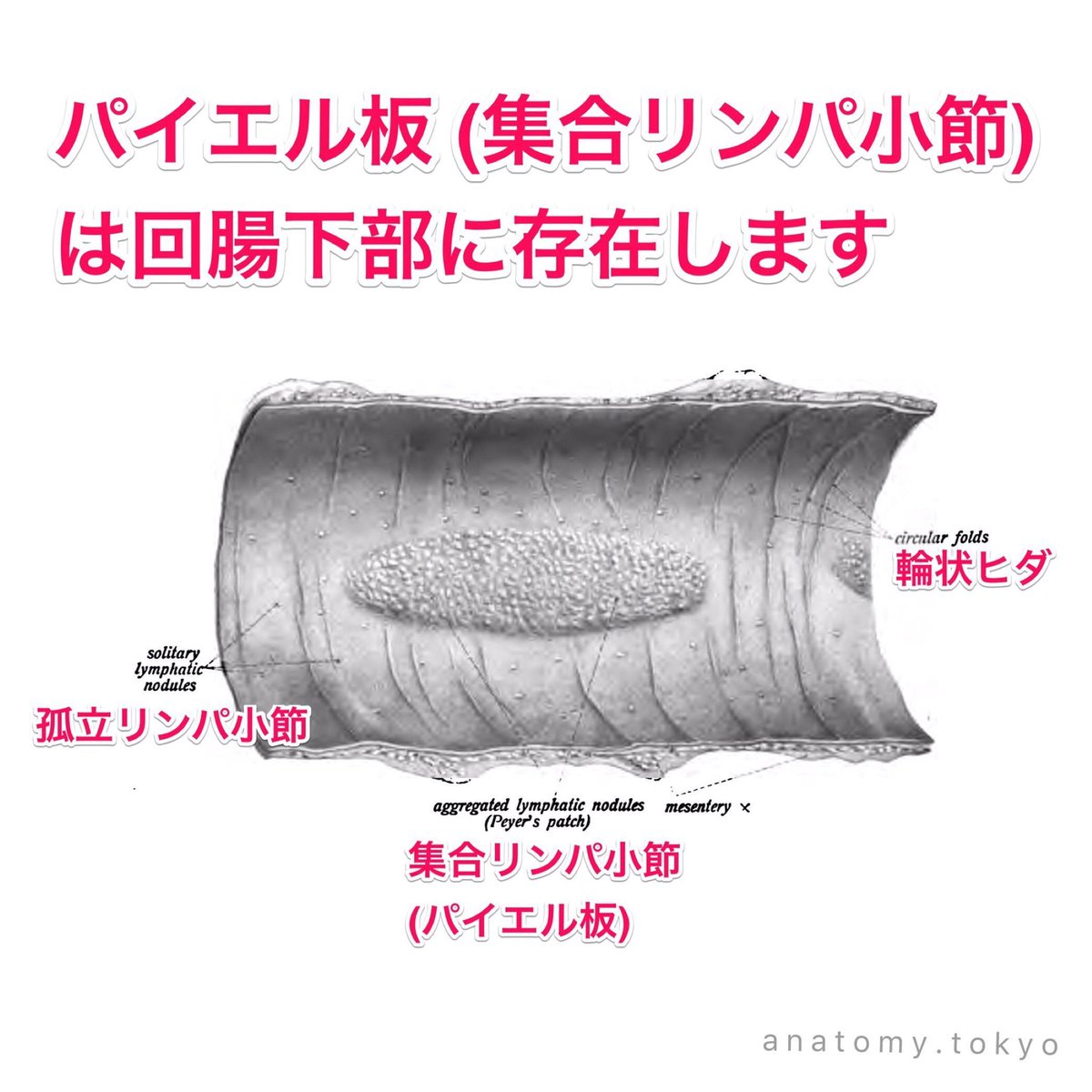 かずひろ先生の 徹底的国試対策 解剖学 Twitter પર パイエル板 集合リンパ小節 は に存在する 解答 回腸下部 パイエル板 集合リンパ小節 は回腸下部に存在します 解剖学 消化器系 小腸 集合リンパ小節 パイエル板 一問一答 T Co