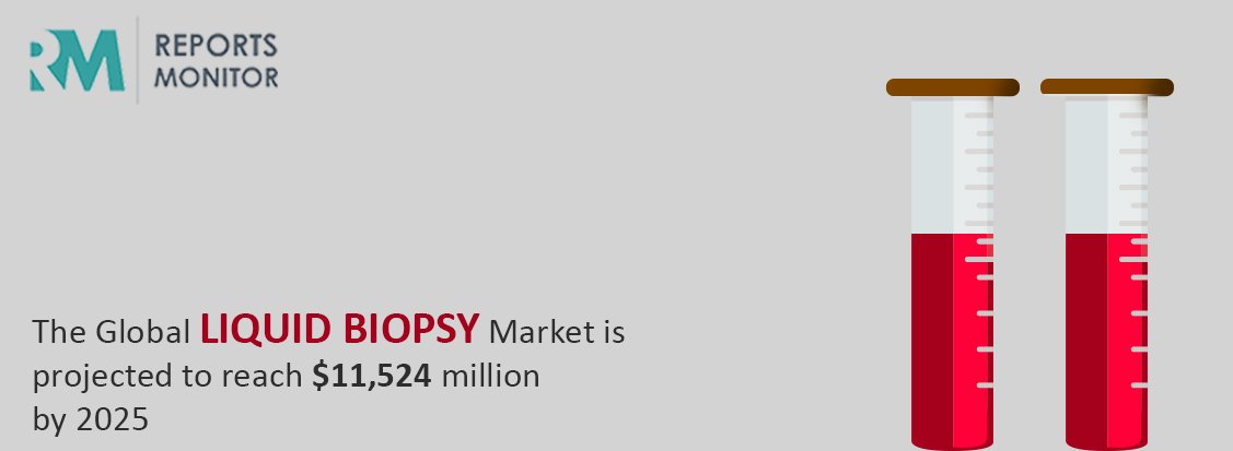 reportsmonitor's tweet photo. The Global #Liquid #Biopsy Market is poised for a multi-fold growth and a significant amount of diagnostic will lead to much potential prospects of the industry.
Read More @ https://t.co/3kIM67q9dh https://t.co/NPajcj7ehb
