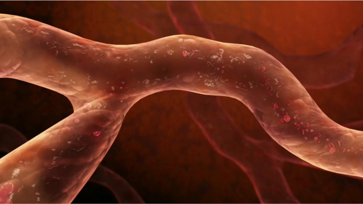 BaddowHospital's tweet photo. Vascular diseases affect blood flow by blocking or weakening blood vessels, or through damage to valves in teh veins. Our consultants can diagnose and manage most vascular conditions. https://t.co/rwcKmf145U